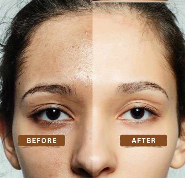 Oily Skin Ka Hal — Ghar Par Facial Routine Pakistan